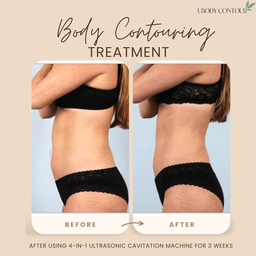 I Tried Body Contouring So You Don’t Have To (But You’ll Probably Want To After This)