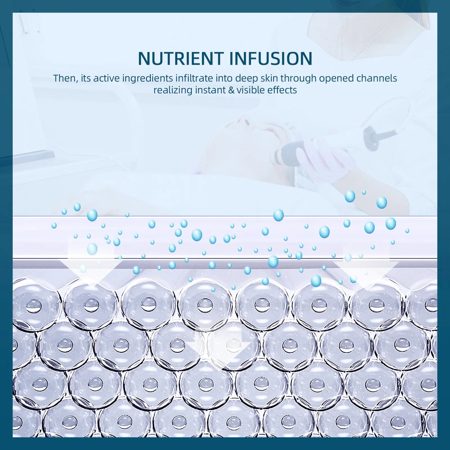 UBodyContour™ Oxygen Bubble Pen - UBody Contour