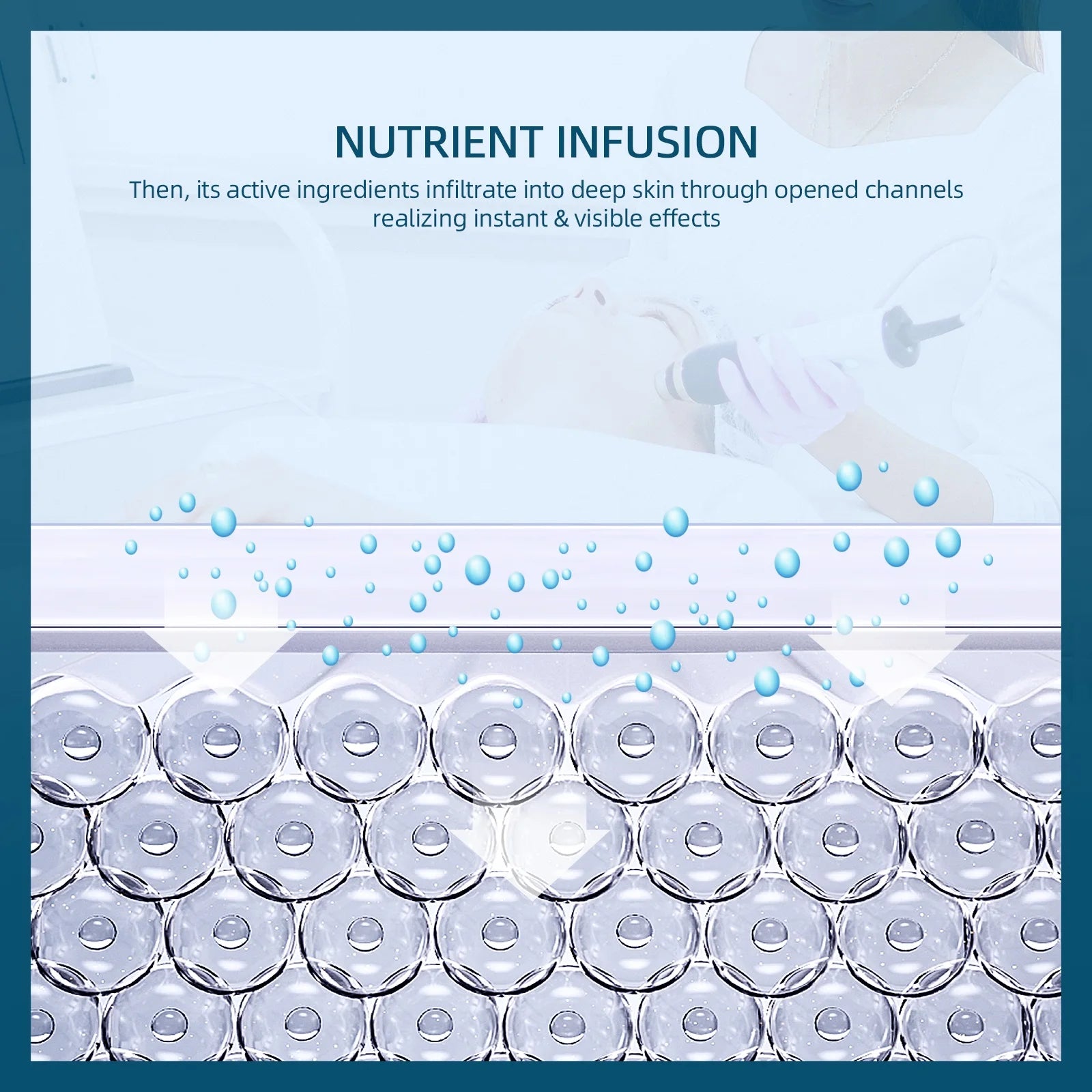 UBodyContour™ Oxygen Bubble Pen - UBody Contour