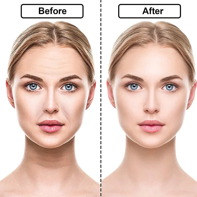 UBodyContour™ Silicone Wrinkle Smoothing Set