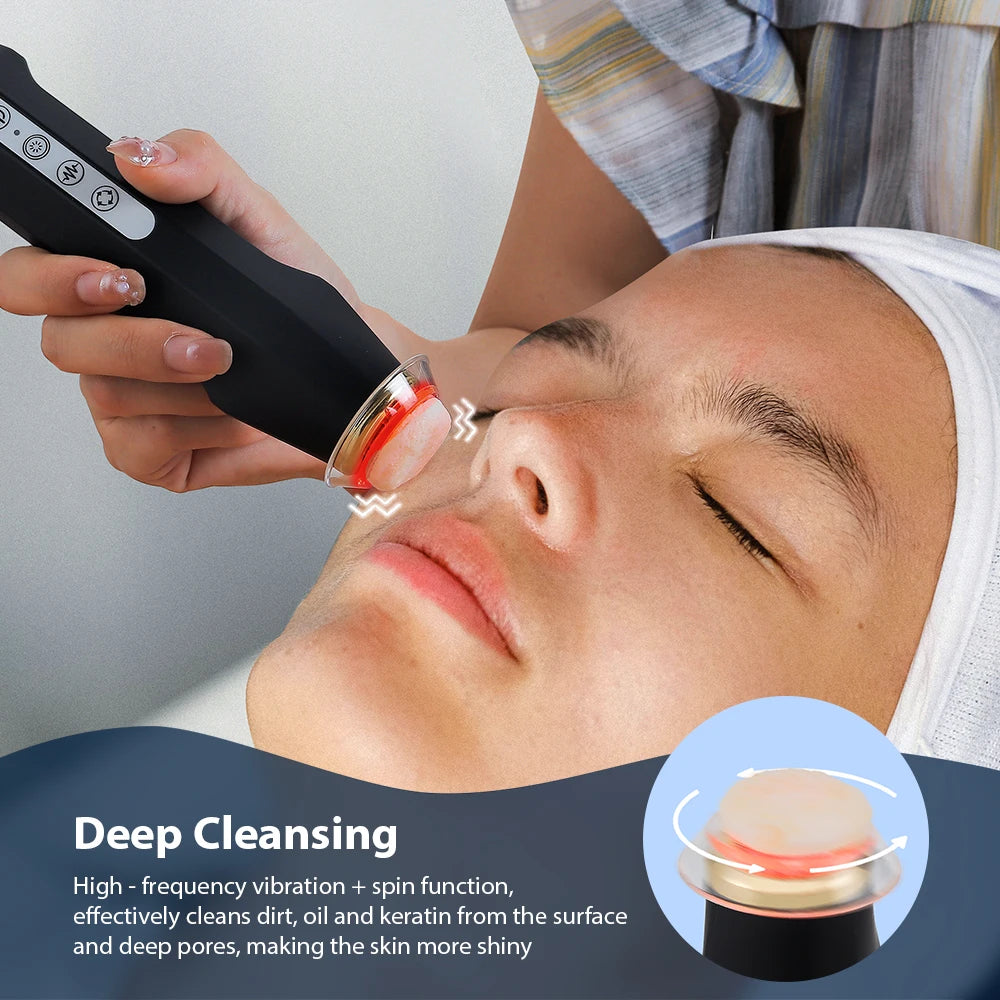 UBodyContour™ Oxygen Pod Sets for Oxygen Bubble Pen - UBody Contour