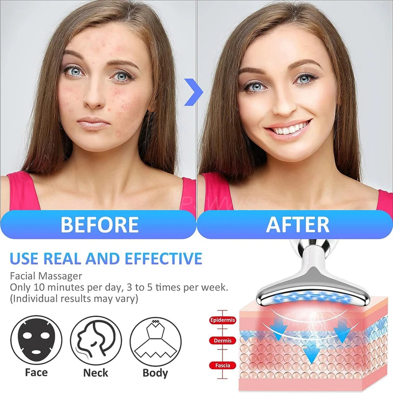 UBodyContour™ Radiance Facial Massager - UBody Contour