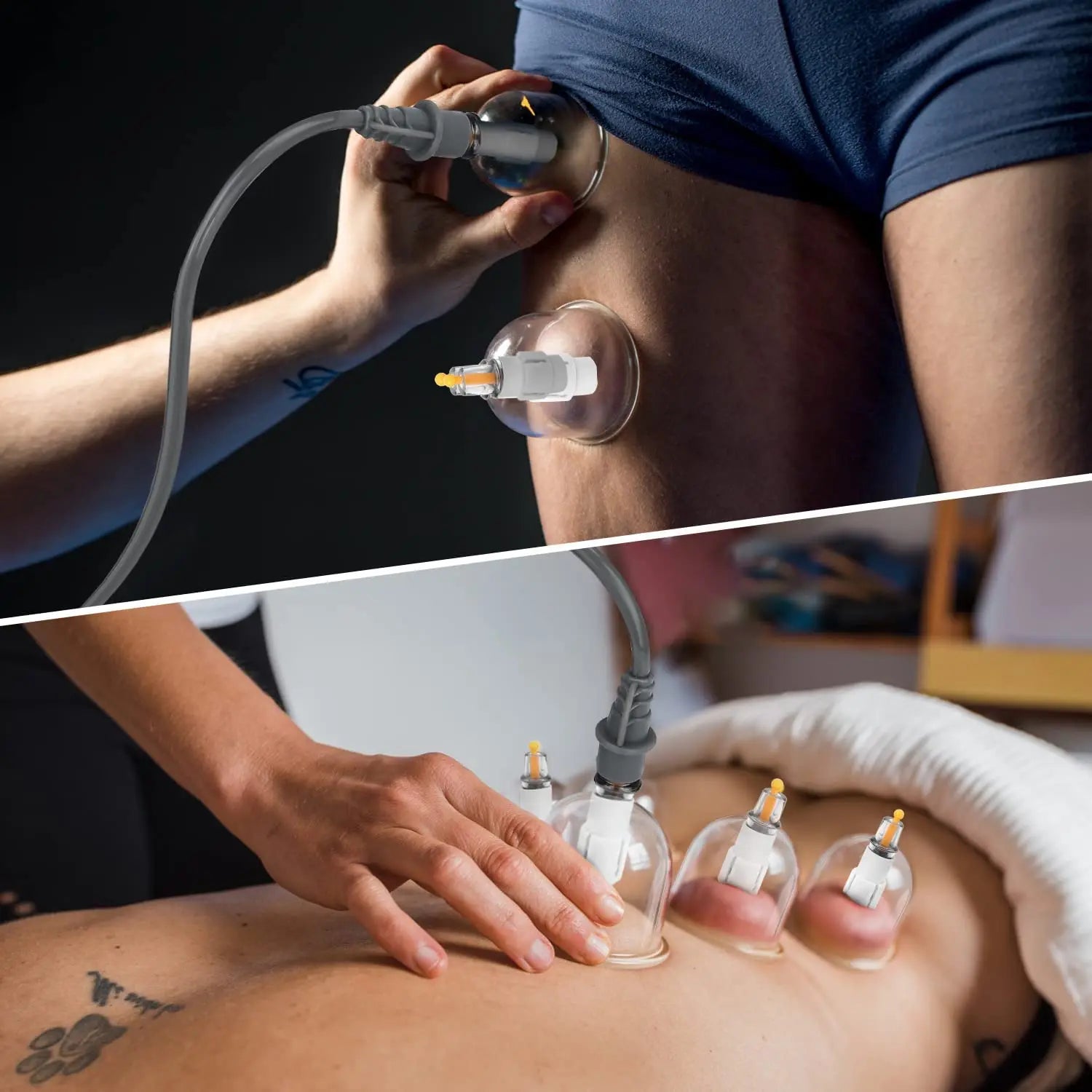 UBodyContour™ Cupping Therapy Set - UBody Contour