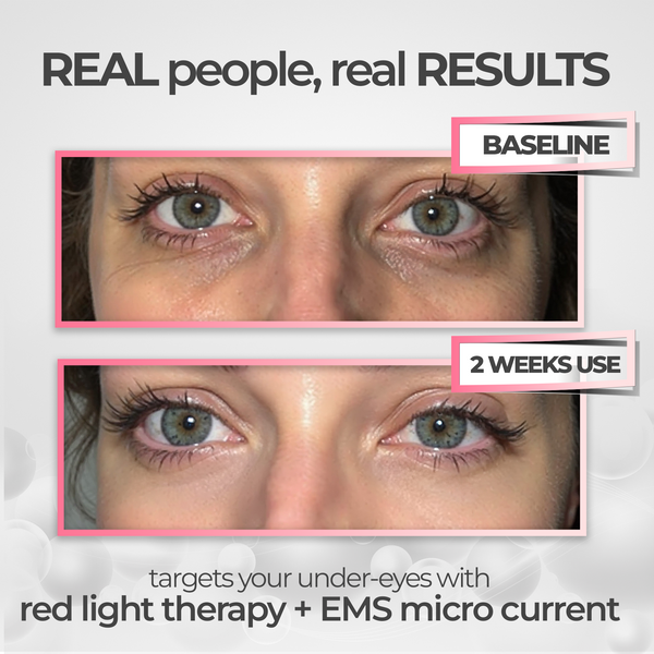 UBodyContour™ Red Light Therapy Eye Massager - UBody Contour