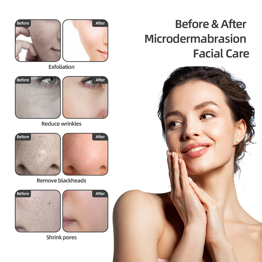 3-in-1 Diamond Facial Device - Microdermabrasion, Blackhead Removal &amp; Hydrating Spray