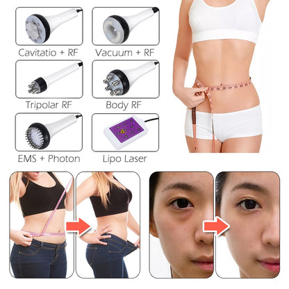 6 In 1 Machine- 80K Ultrasonic Cavitation - Vacuum - Radio Frequency -Laser Lipo Pads - UBodyContour