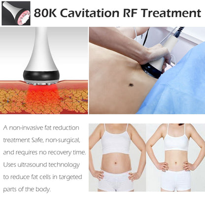 6 In 1 Machine- 80K Ultrasonic Cavitation - Vacuum - Radio Frequency -Laser Lipo Pads - UBodyContour